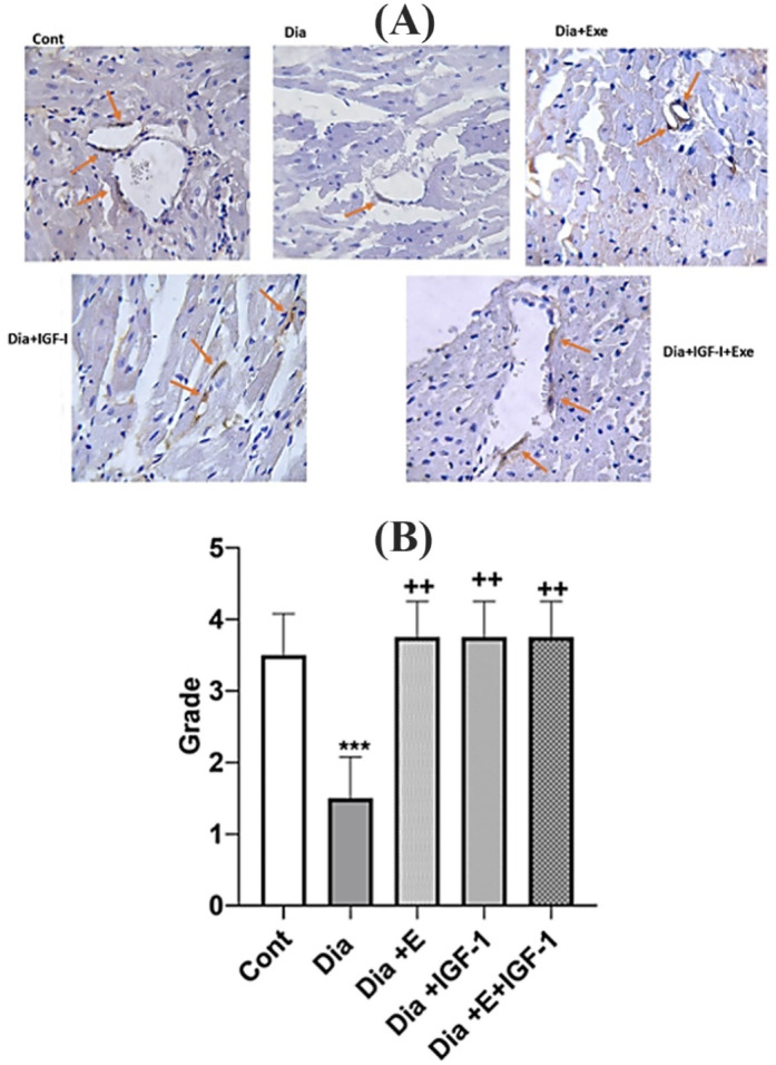 Decreased Cardiac NOX4 and SIRT-1 Protein Levels Contribute to Decreased Angiogenesis in the Heart of Diabetic Rats: Rescue Effects of IGF-1 and Exercise.