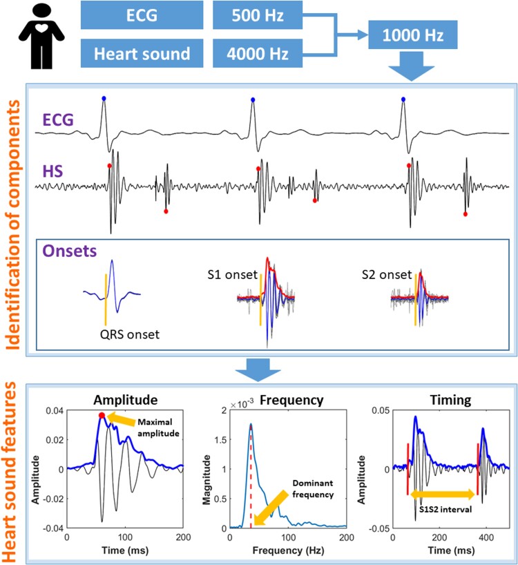 Association between phonocardiography and echocardiography in heart failure patients with preserved ejection fraction.