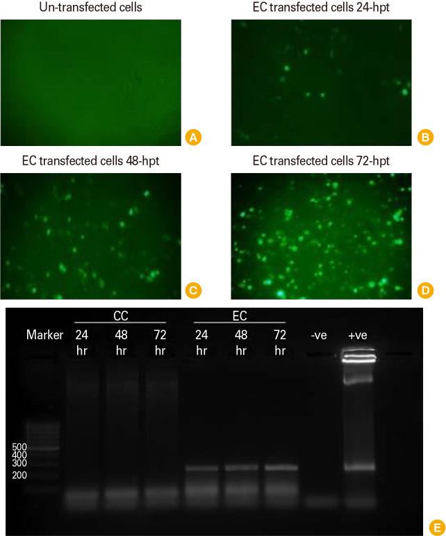 Individual expression and processing of hepatitis C virus E1/E2 epitopes-based DNA vaccine candidate in healthy humans' peripheral blood mononuclear cells.