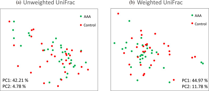 Impact of <i>Bifidobacterium adolescentis</i> in patients with abdominal aortic aneurysm: a cross-sectional study.