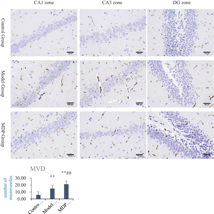 The promoting effect of modified Dioscorea pills on vascular remodeling in chronic cerebral hypoperfusion via the Ang/Tie signaling pathway.