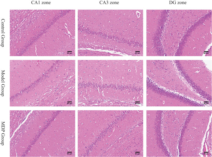 The promoting effect of modified Dioscorea pills on vascular remodeling in chronic cerebral hypoperfusion via the Ang/Tie signaling pathway.