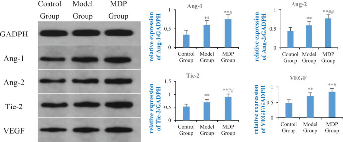 The promoting effect of modified Dioscorea pills on vascular remodeling in chronic cerebral hypoperfusion via the Ang/Tie signaling pathway.