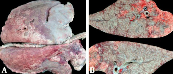 Evaluation of the relationship between inflammatory reaction and interleukins in ovine pulmonary adenocarcinomas.