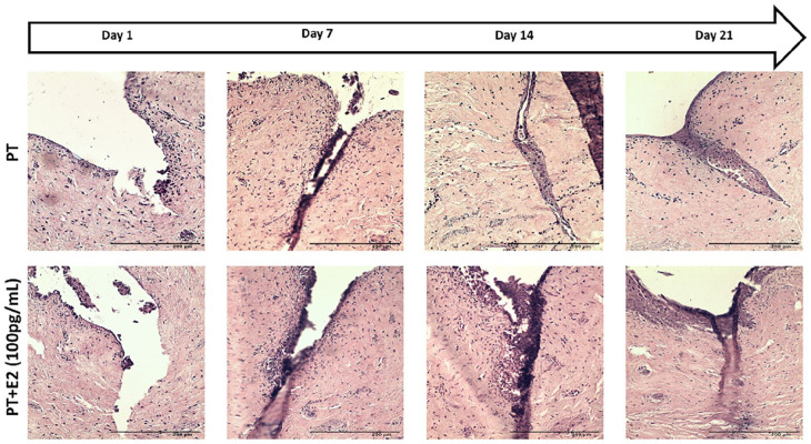 Estradiol-17β [E<sub>2</sub>] stimulates wound healing in a 3D in vitro tissue-engineered vaginal wound model.