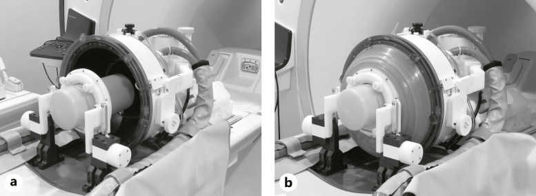 Improvement in Intraoperative Image Quality in Transcranial Magnetic Resonance-Guided Focused Ultrasound Surgery Using Transmitter Gain Adjustment.