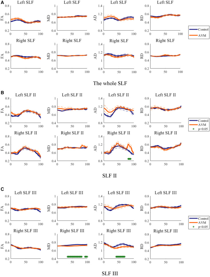 Language function of the superior longitudinal fasciculus in patients with arteriovenous malformation as evidenced by automatic fiber quantification.