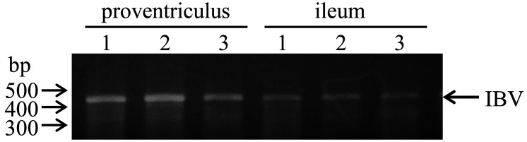 Effects of Newcastle Disease/Infectious Bronchitis Vaccine and Feeding Yeast Products on the Innate Immune System in the Proventriculus and Ileum of Broiler Chicks.