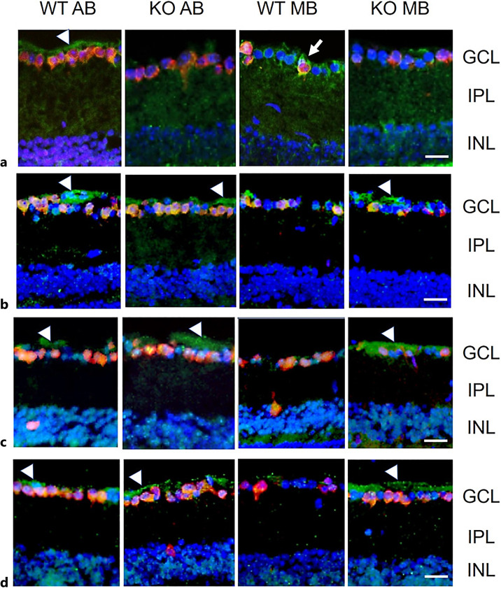 Effects of Elevated Intraocular Pressure on Retinal Ganglion Cell Density and Expression and Interaction of Retinal Aquaporin 9 and Monocarboxylate Transporters.