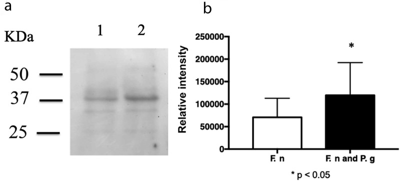 <i>Porphyromonas gingivalis</i> diffusible signaling molecules enhance <i>Fusobacterium nucleatum</i> biofilm formation <i>via</i> gene expression modulation.