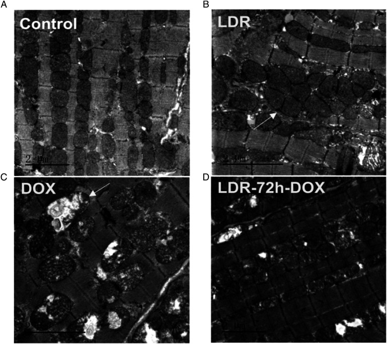 Low-Dose Radiation Reduces Doxorubicin-Induced Myocardial Injury Through Mitochondrial Pathways.