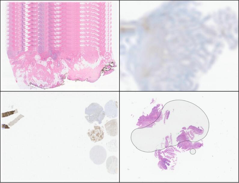 Digital pathology implementation in a private laboratory: The CEDAP experience