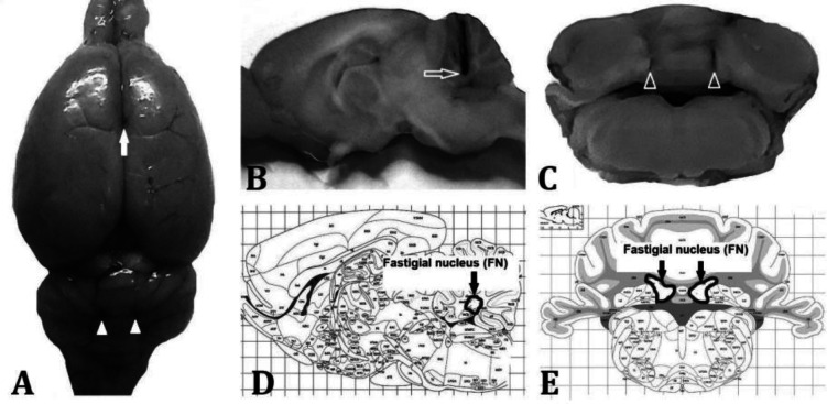 Cerebellar fastigial nucleus histamine and its H<sub>2</sub> but not H<sub>1</sub> receptors might inhibit acetic acid-induced visceral nociception and improve motor coordination in rats: role of opioid system.