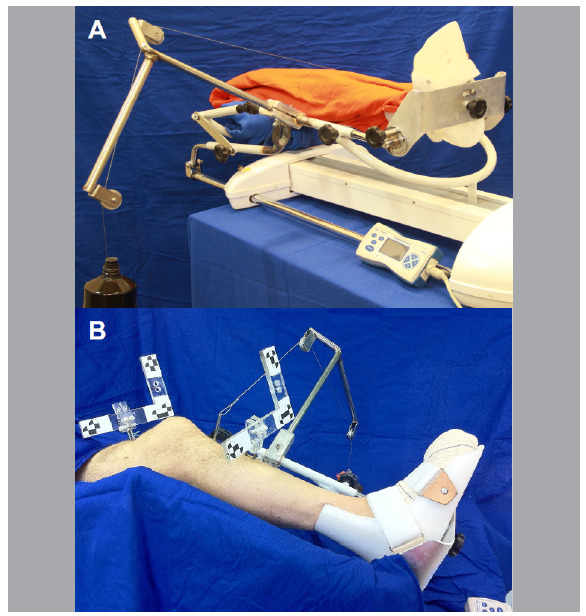 ANTEROMEDIAL OR CENTRAL ANATOMIC ACL RECONSTRUCTION? A CADAVERIC HIP-TO-TOE STUDY.