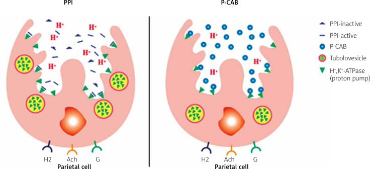 Potassium-competitive acid blockers, a new therapeutic class, and their role in acid-related diseases: a narrative review.