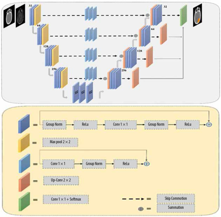 Fully automated clinical target volume segmentation for glioblastoma radiotherapy using a deep convolutional neural network.