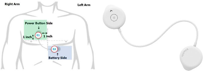 A descriptive study of the clinical impacts on COVID-19 survivors using telemonitoring (The TeleCOVID Study).