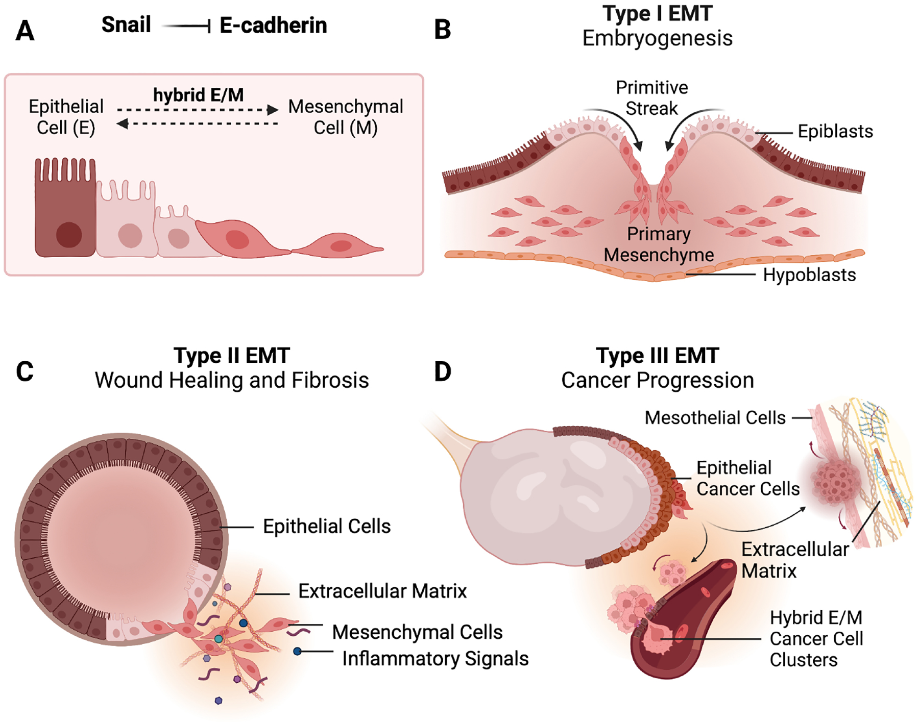 Role of epithelial-mesenchymal transition factor SNAI1 and its targets in ovarian cancer aggressiveness.