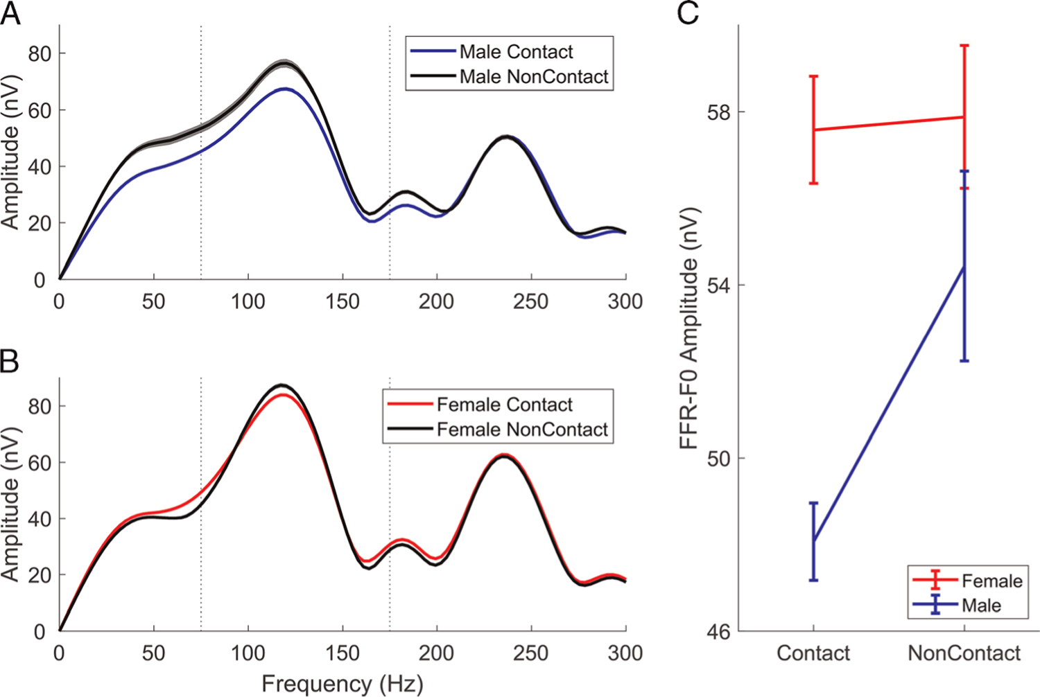 Subconcussion revealed by sound processing in the brain.