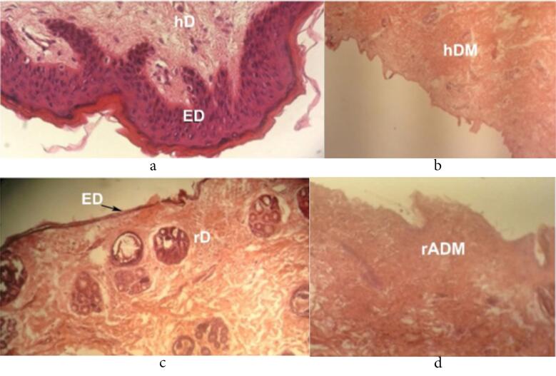 Mechanical properties of the rabbit and human decellularized patches for well-tolerated/reinforced organ in cardiac tissue engineering.
