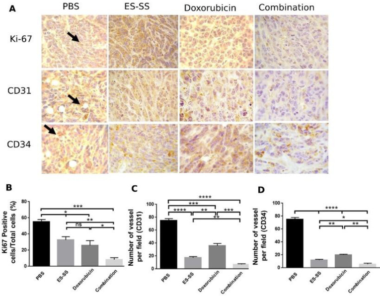 Combination Therapy in Cancer: Doxorubicin in Combination with an N-terminal Peptide of Endostatin Suppresses Angiogenesis and Stimulates Apoptosis in the Breast Cancer.