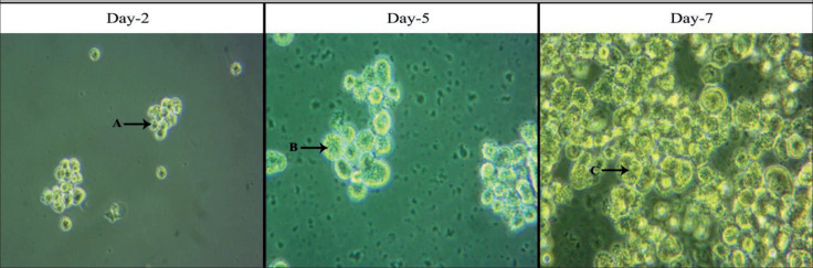 Water Extract Have Superior Cytotoxic Effect Than Ethanolic Extract of Clinacanthus Nutans Leaves in Breast Cancer Stem Cells.
