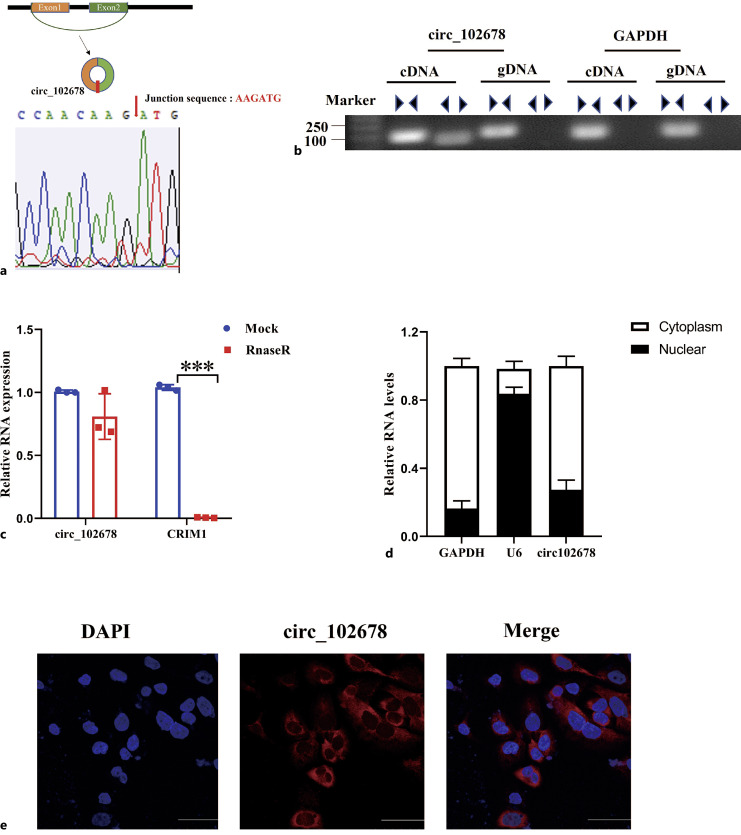 YTHDC1-Modified m6A Methylation of Hsa_circ_0102678 Promotes Keratinocyte Inflammation Induced by Cutibacterium acnes Biofilm through Regulating miR-146a/TRAF6 and IRAK1 Axis.