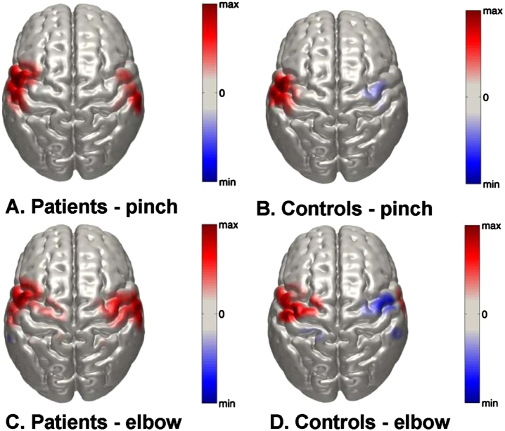 Feasibility of using fNIRS to explore motor-related regional haemodynamic signal changes in patients with sensorimotor impairment and healthy controls: A pilot study.