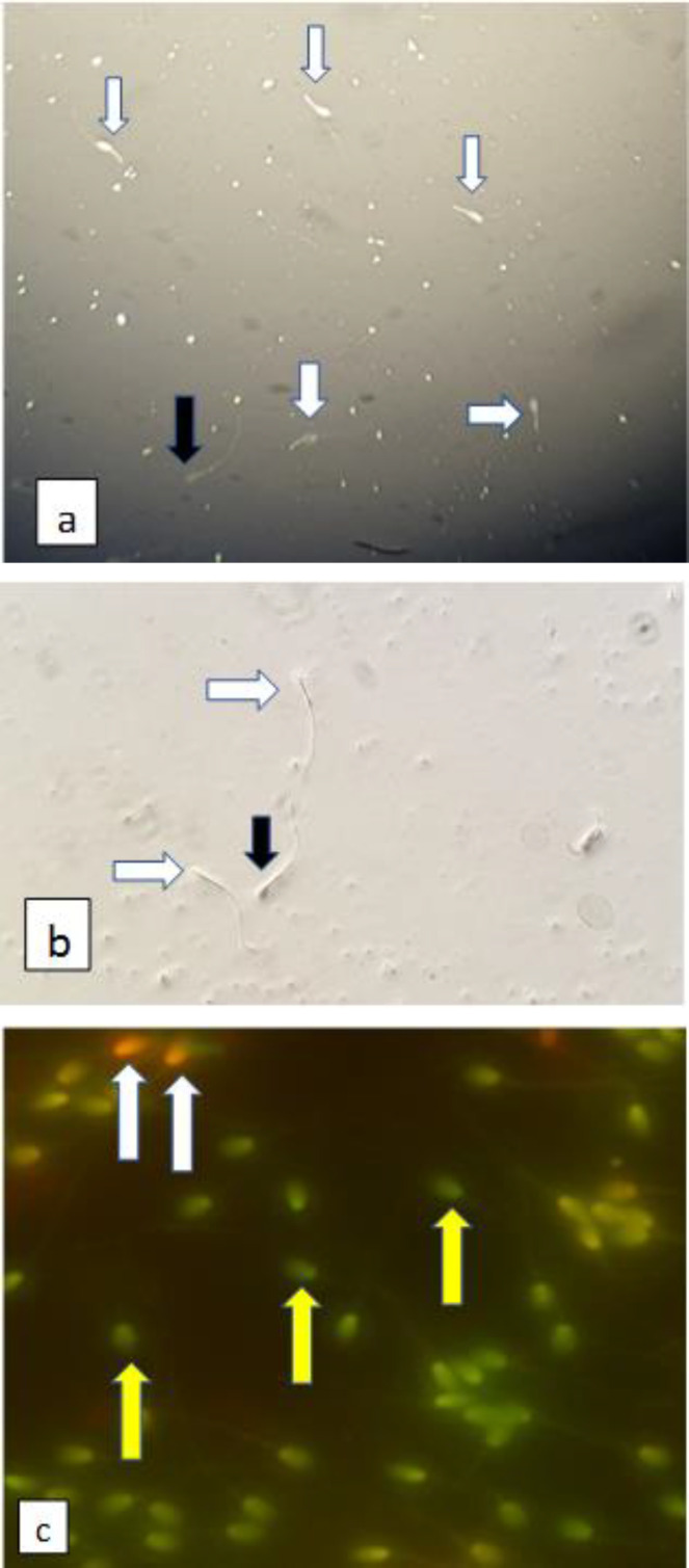 The effect of different concentrations of taxifolin on the quality of frozen and thawed semen of Simmental cattle.