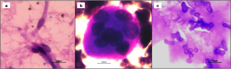 Clinicopathological investigation of nutritional osteodystrophia fibrosa in a flock of young stall-fed goats.