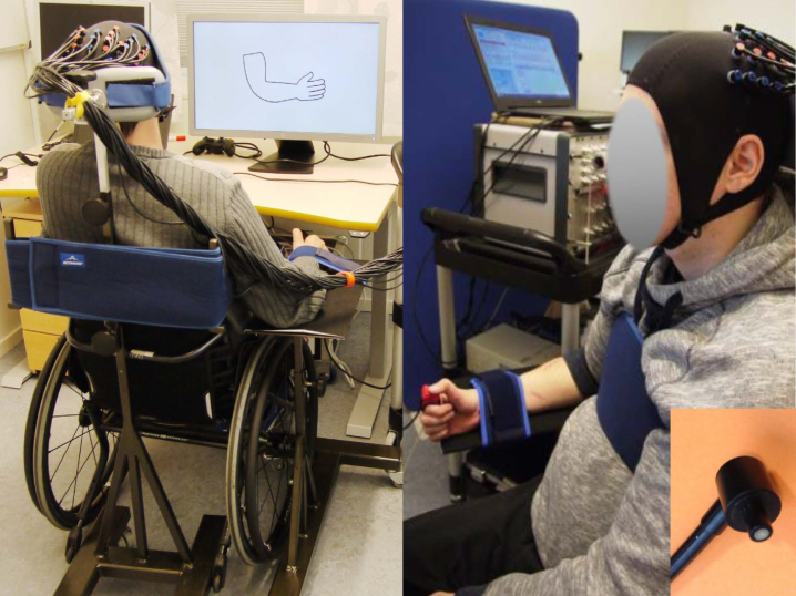 Feasibility of using fNIRS to explore motor-related regional haemodynamic signal changes in patients with sensorimotor impairment and healthy controls: A pilot study.
