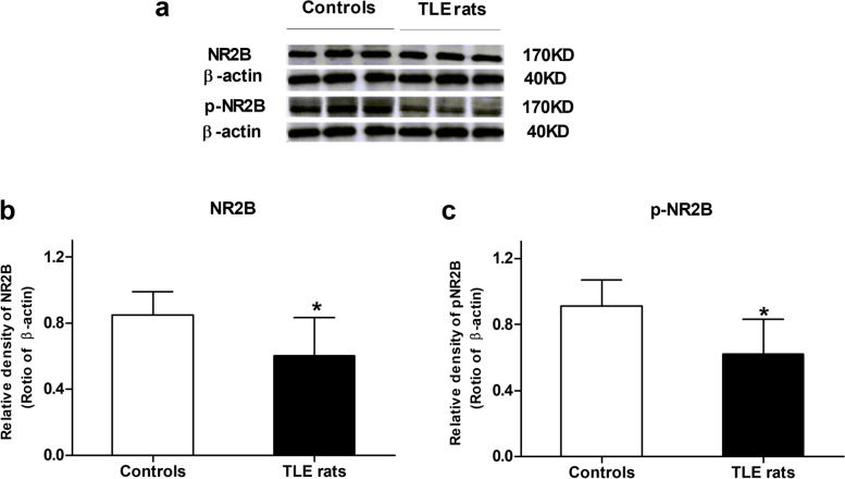 The effect of hippocampal NR2B-containing NMDA receptors on chronic cognitive dysfunction in rats with temporal lobe epilepsy.