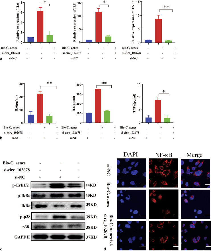 YTHDC1-Modified m6A Methylation of Hsa_circ_0102678 Promotes Keratinocyte Inflammation Induced by Cutibacterium acnes Biofilm through Regulating miR-146a/TRAF6 and IRAK1 Axis.