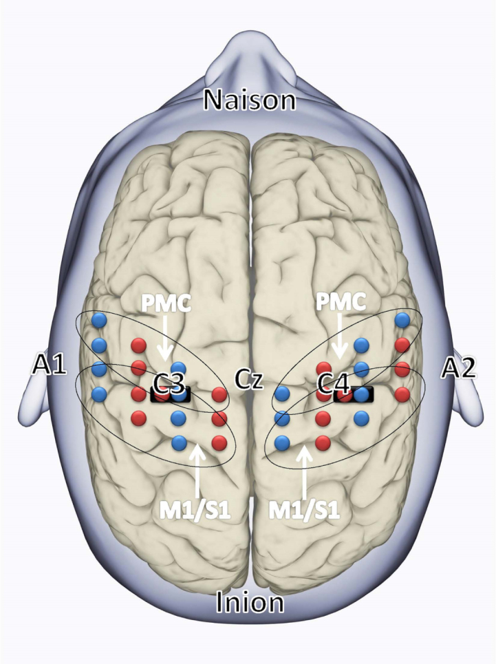 Feasibility of using fNIRS to explore motor-related regional haemodynamic signal changes in patients with sensorimotor impairment and healthy controls: A pilot study.