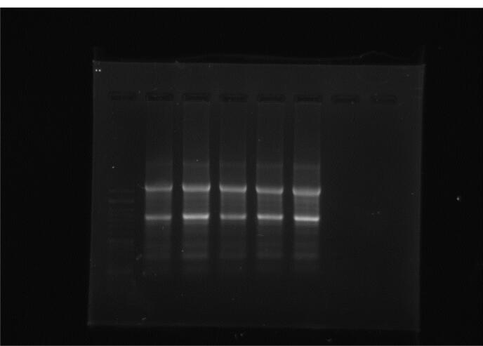 Evaluation of MMP-9, IL-6, TNF-α levels and peripheral blood mononuclear cells genes expression of MMP-9 and TIMP-1 in Iranian patients with coronary artery disease.