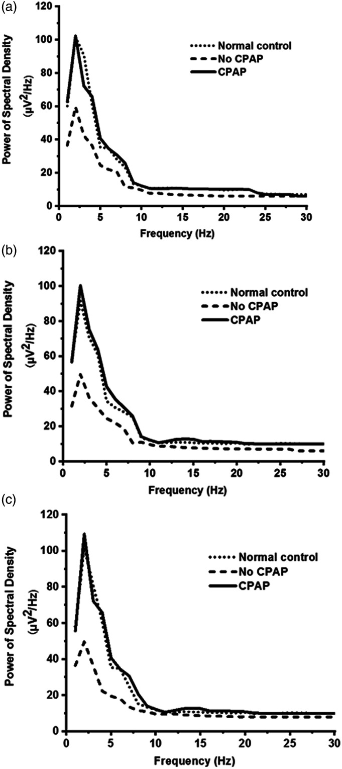 Effects of CPAP treatment on electroencephalographic activity in patients with obstructive sleep apnea syndrome during deep sleep: Preliminary findings of a cross-sectional study.