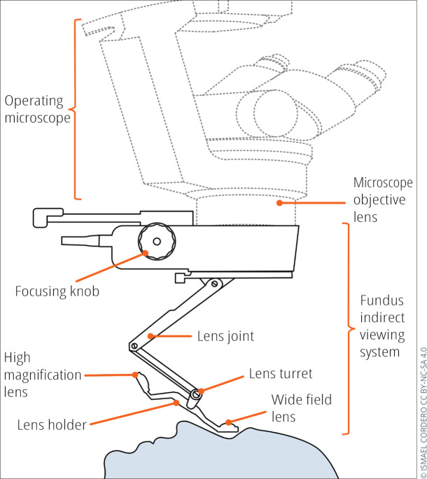 Vitreoretinal surgery: an introduction to simulation training.