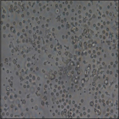Dendritic Cell-Based Immunity: Screening of Dendritic Cell Subsets in Breast Cancer-Bearing Mice.