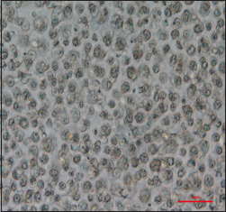 Dendritic Cell-Based Immunity: Screening of Dendritic Cell Subsets in Breast Cancer-Bearing Mice.