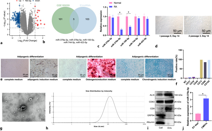 Bone Marrow Mesenchymal Stem Cells Release miR-378a-5p-Carried Extracellular Vesicles to Alleviate Rheumatoid Arthritis.