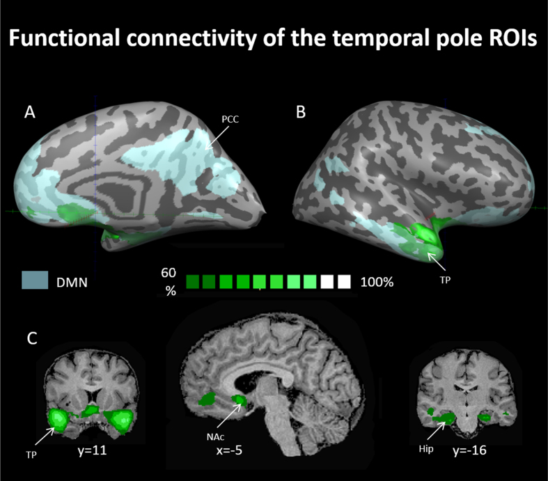 Integrating mind and body: Investigating differential activation of nodes of the default mode network.