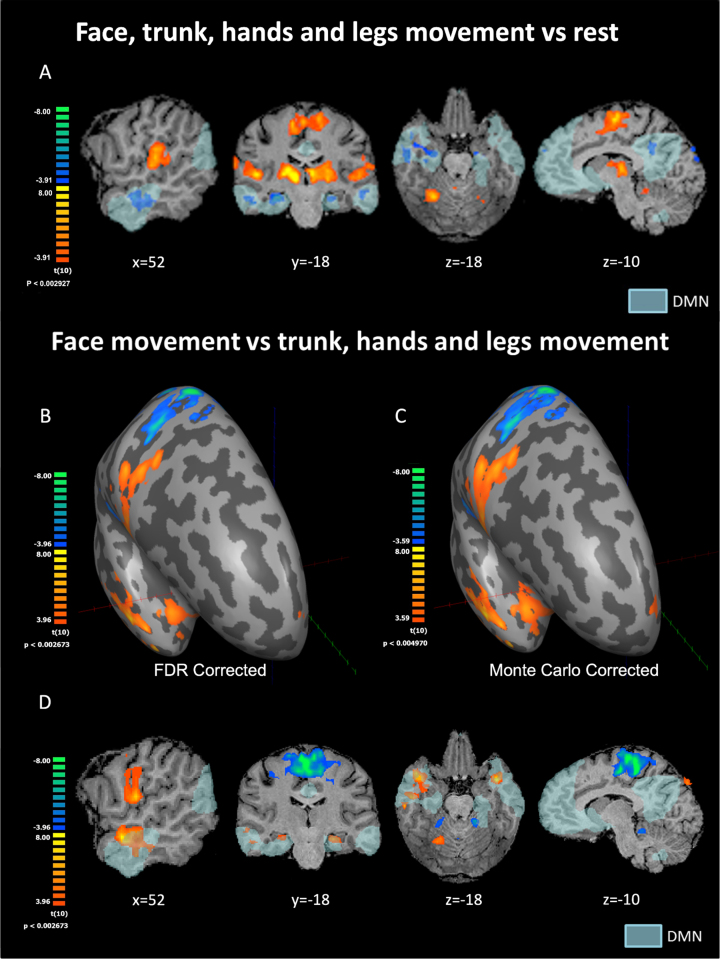 Integrating mind and body: Investigating differential activation of nodes of the default mode network.