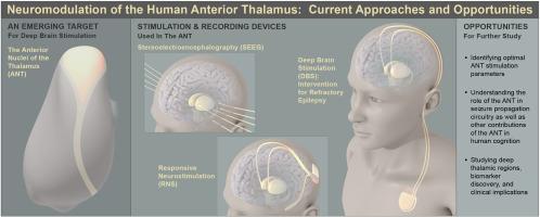 Neuromodulation of the anterior thalamus: Current approaches and opportunities for the future