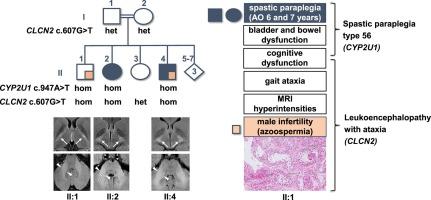 Co-occurrence of CLCN2-related leukoencephalopathy and SPG56