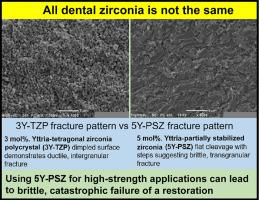 Survey of the mechanical and physical behaviors of yttria-stabilized zirconia from multiple dental laboratories