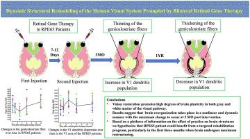 Dynamic structural remodeling of the human visual system prompted by bilateral retinal gene therapy