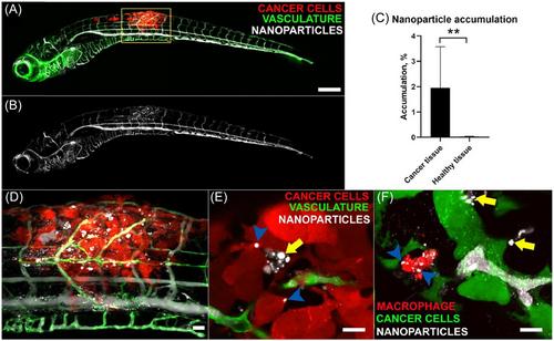 Nanoparticle delivery through the BBB in central nervous system tuberculosis