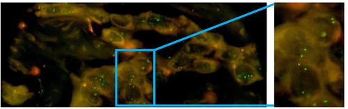 First proficiency testing for NGS-based and combined NGS- and FISH-based detection of FGFR2 fusions in intrahepatic cholangiocarcinoma