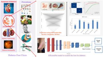 Diabetic foot ulcer detection using deep learning approaches