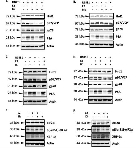 Estrogens drive the endoplasmic reticulum-associated degradation and promote proto-oncogene c-Myc expression in prostate cancer cells by androgen receptor/estrogen receptor signaling